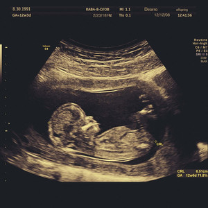 黄色小说嗯嗯啊啊视频试看
